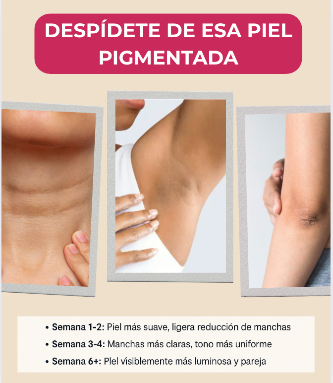 ACLARÍ PRO – Crema Despigmentante Intensiva