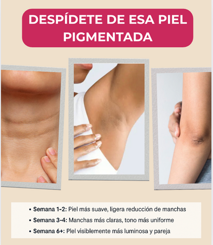 ACLARÍ PRO – Crema Despigmentante Intensiva